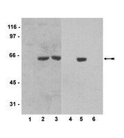 Anti-Myc Tag Antibody, clone 4A6 | 05-724